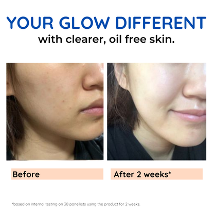 10% Niacinamide Face Serum for Glowing Skin, Oil Control & Acne Care | 30ml (Pack of 1)