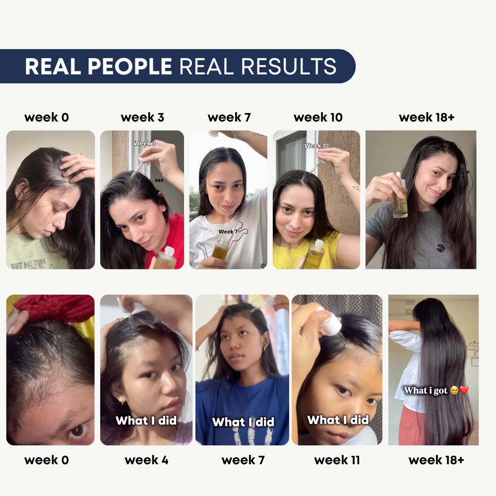 Glad I Met You The Complete Hair Duo — Hair Growth Serum (40ml) + Anti Dandruff Shampoo (100ml)
