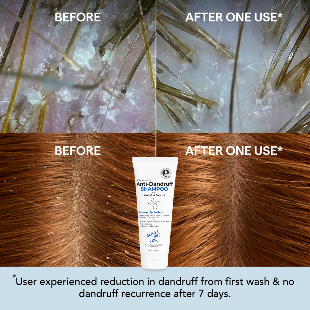 Anti-Dandruff Shampoo with Hair Fall Control (Pack of 2)