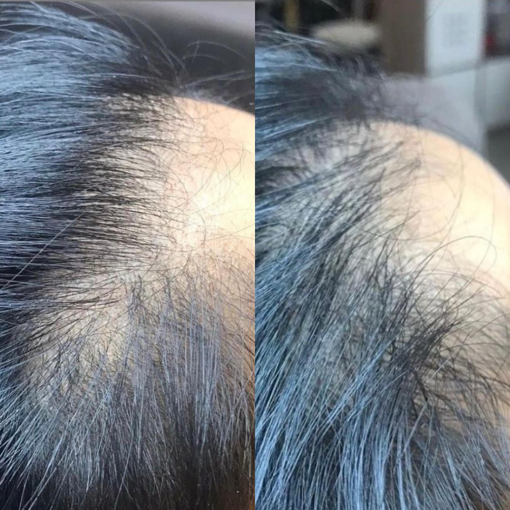 saw new hair growth & baby hair.