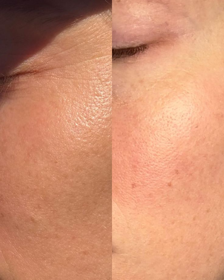 love this K-beauty formula used.